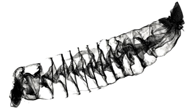 太平洋多刺角鲨螺旋肠